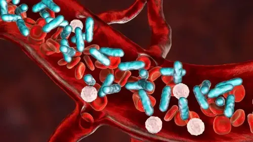 How Do You Avoid Sepsis?